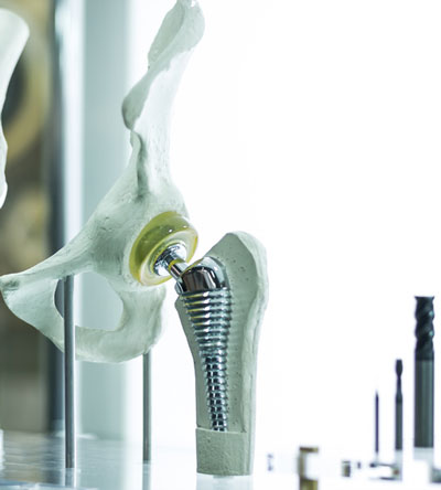 Modell einer Hüftendoprothese